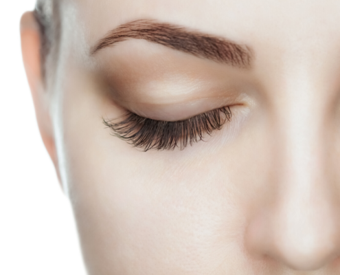 Lifting del sopracciglio